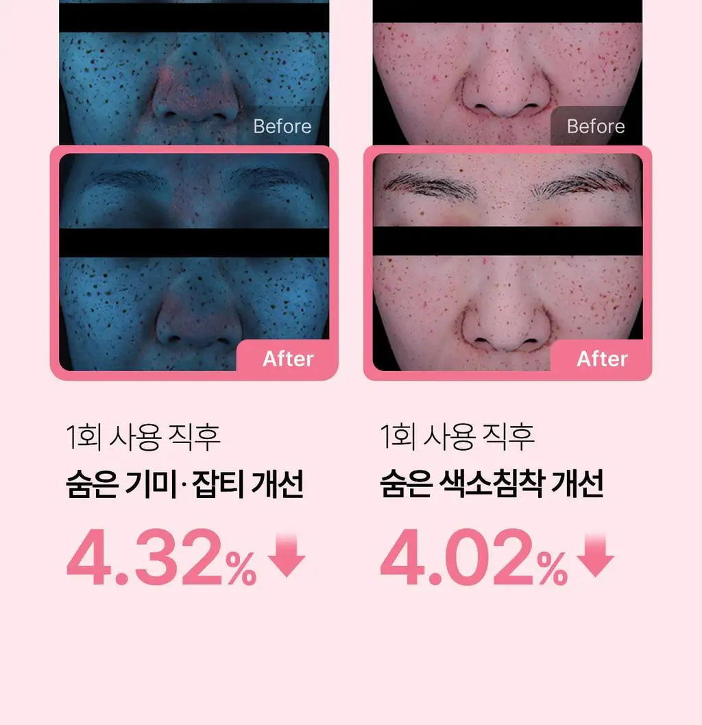 [NEW/붙이는앰플] 메디큐브 PDRN 핑크 펩타이드 앰플 마스크 1매 상세페이지 17